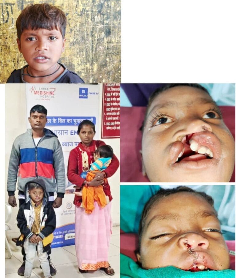  Little Vikram is writing a new chapter of cheerful smile from the forest region of Bastar.