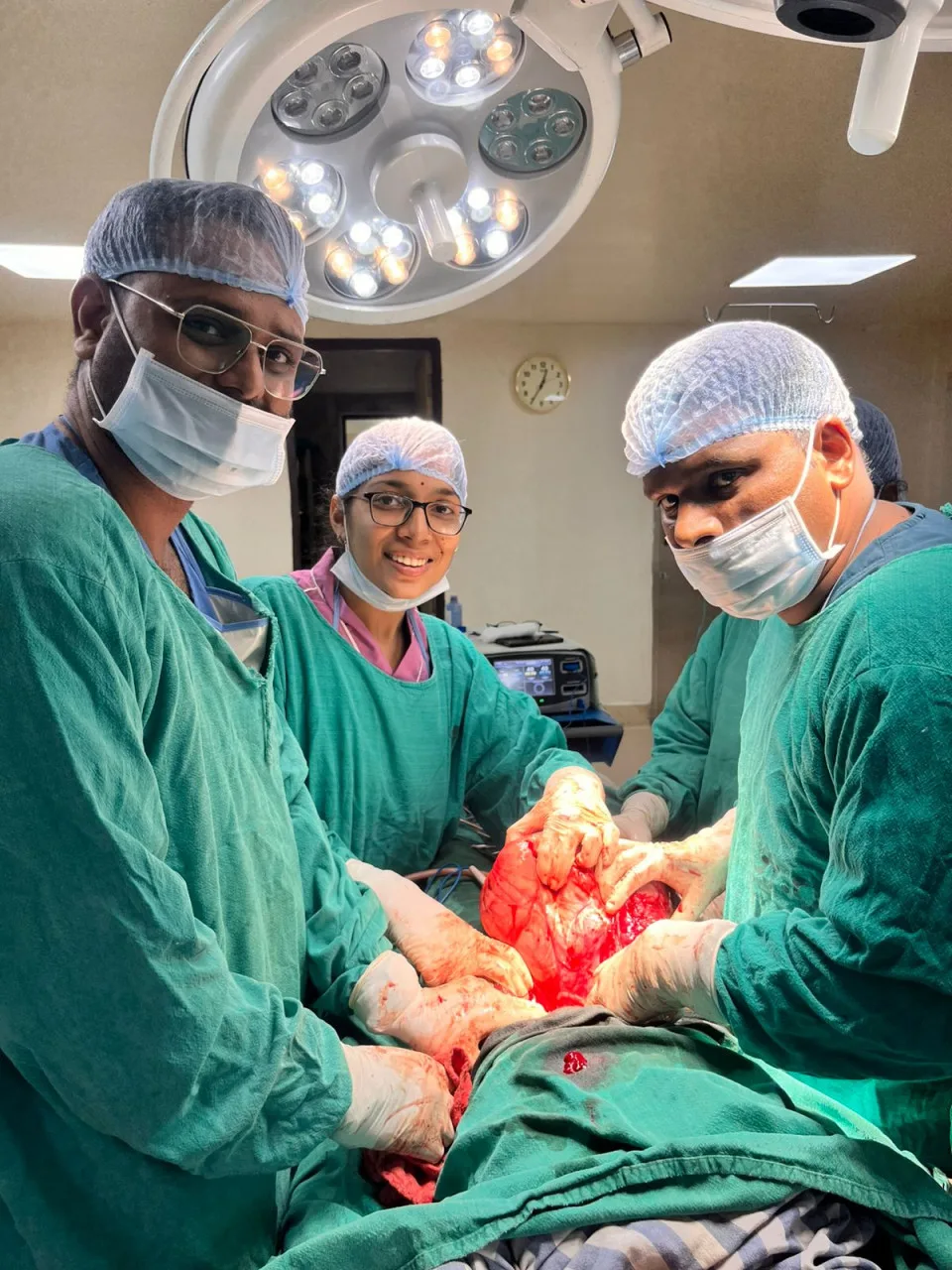 Achievement of the doctors of Raigarh Medical College: A giant tumor weighing 8 kg was removed from the stomach of a woman.